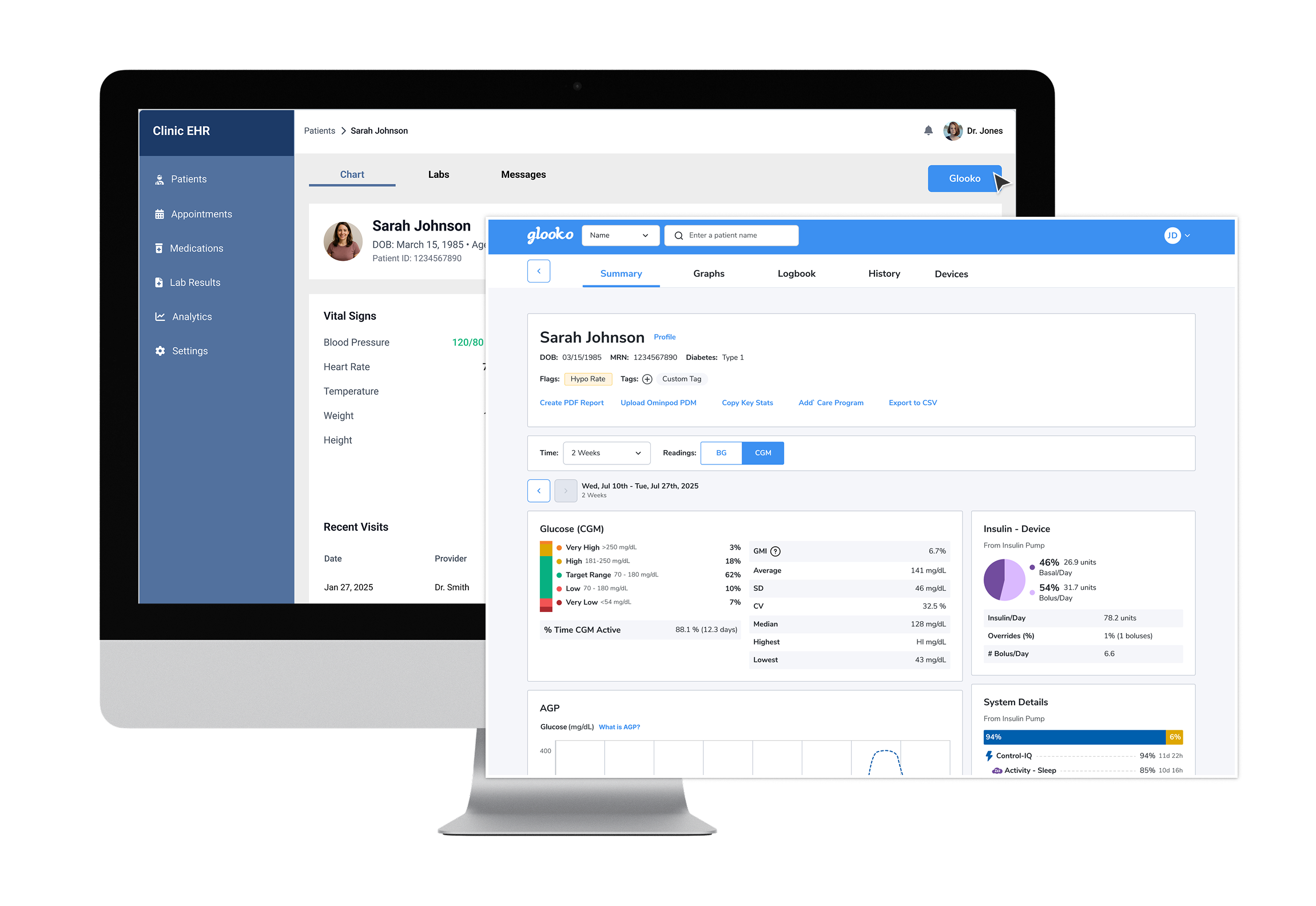 EHR Integration with Glooko T1